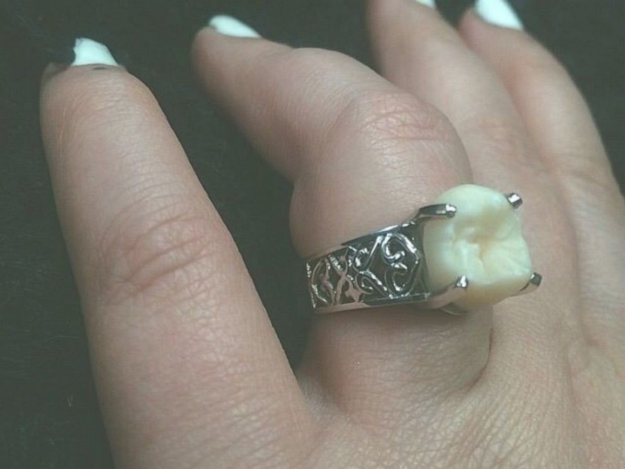 Easy Weddings Wisdom Tooth 3